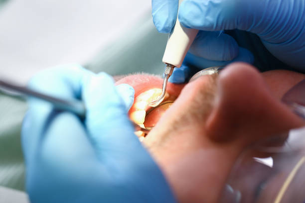 Best Emergency Treatment for Toothache in Forestville, OH